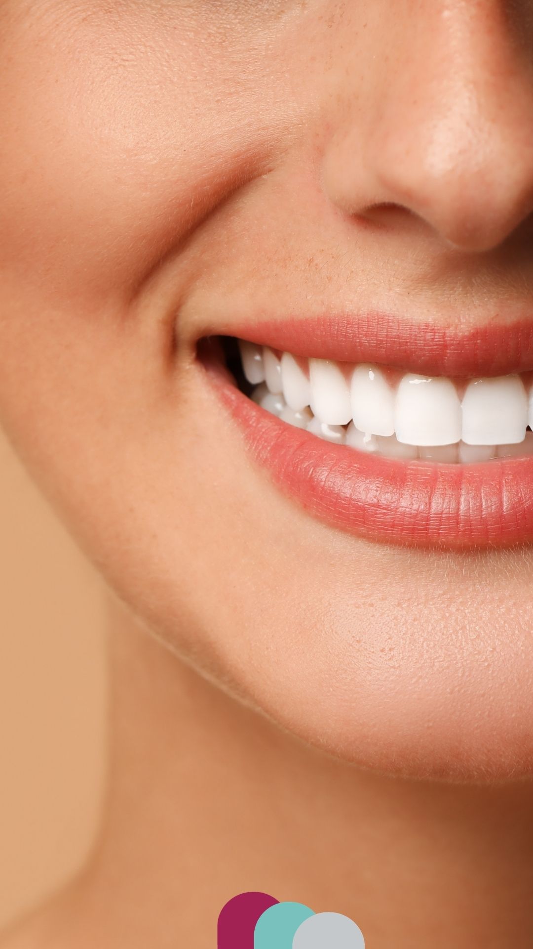 veneers in corby