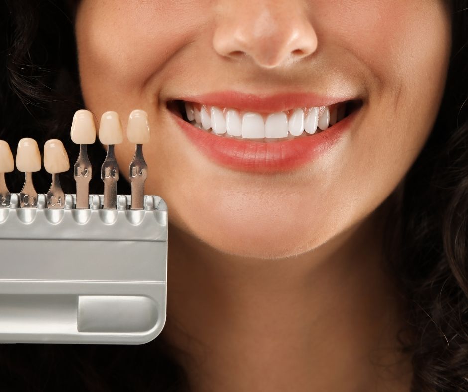 teeth whitening corby